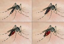 Santé: Comprendre le virus Zika