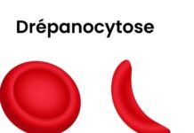 Piège silencieux de la drépanocytose Aimer ne suffit pas toujours, il faut aussi savoir