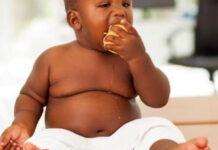 Obésité chez l’enfant : Derrière le poids, une maladie chronique aux conséquences sous-estimées
